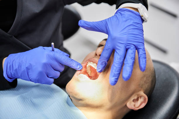 Best Emergency Gum Treatment in Celina, TX